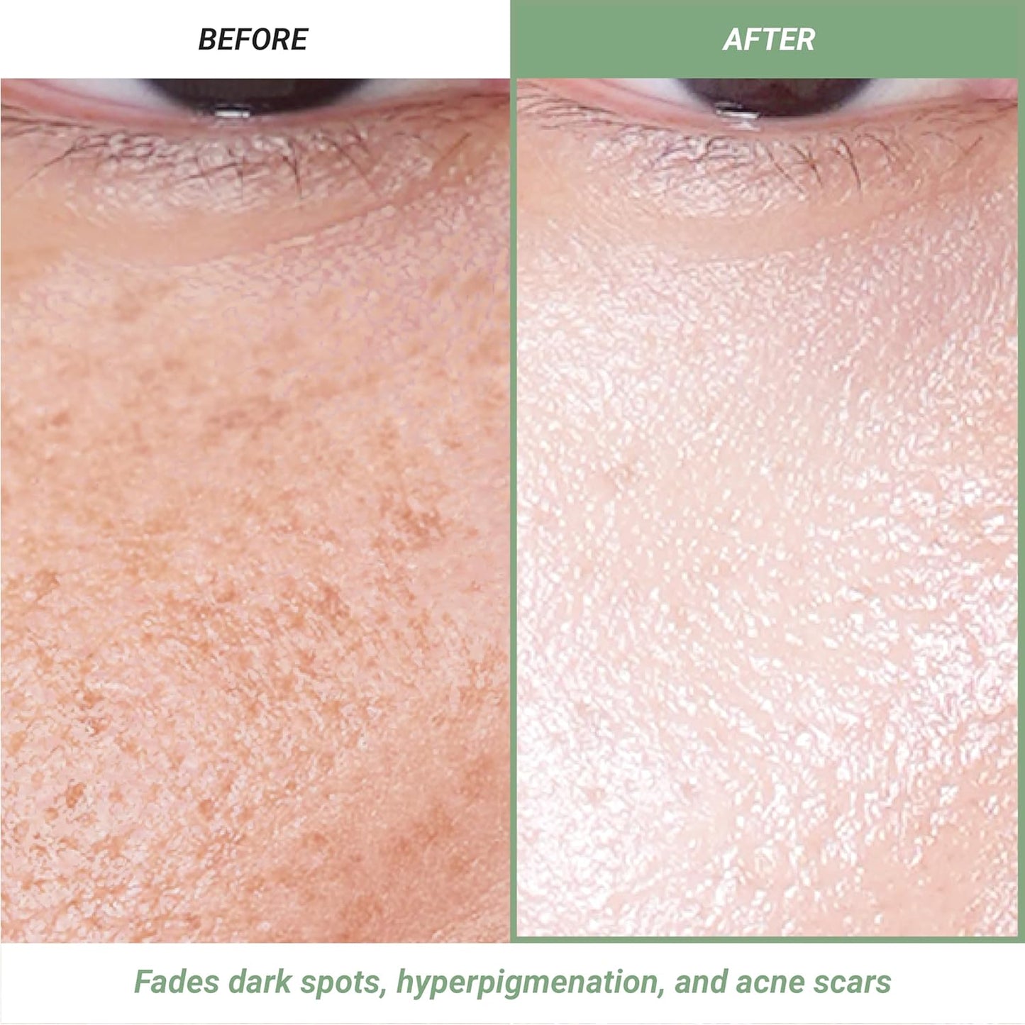 Meebak Korean Vitamin C Serum | Brightening Dark Spot Remover | Soothing Anti Aging & Skin Brightening w/Centella Asiatica, Panthenol, & Adenosine