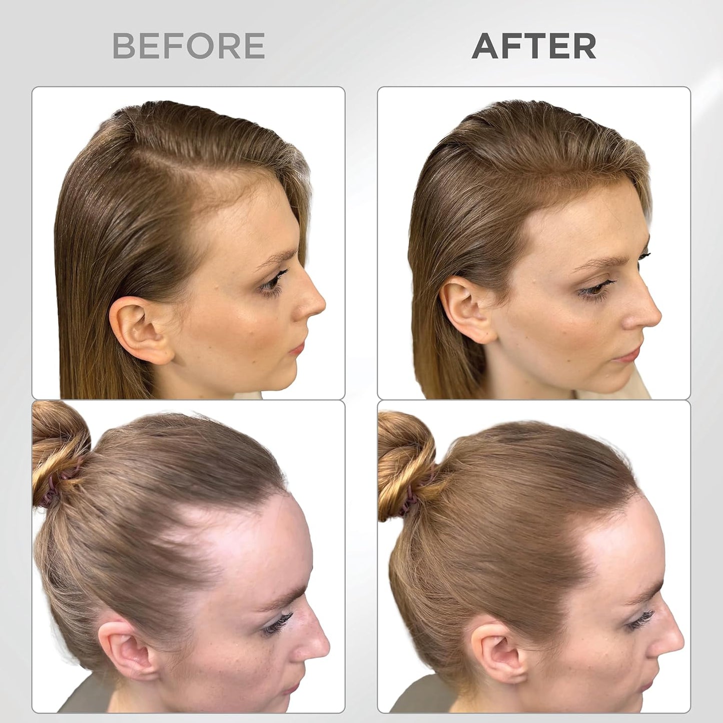 THICK FIBER Root Touch Up & Hairline Powder with Brush (LARGE 10g) – Covers Grey Roots, Thinning Hair & Bald Spots – Sweat & Water Resistant Hair Concealer for Women & Men (Medium Golden Brown)