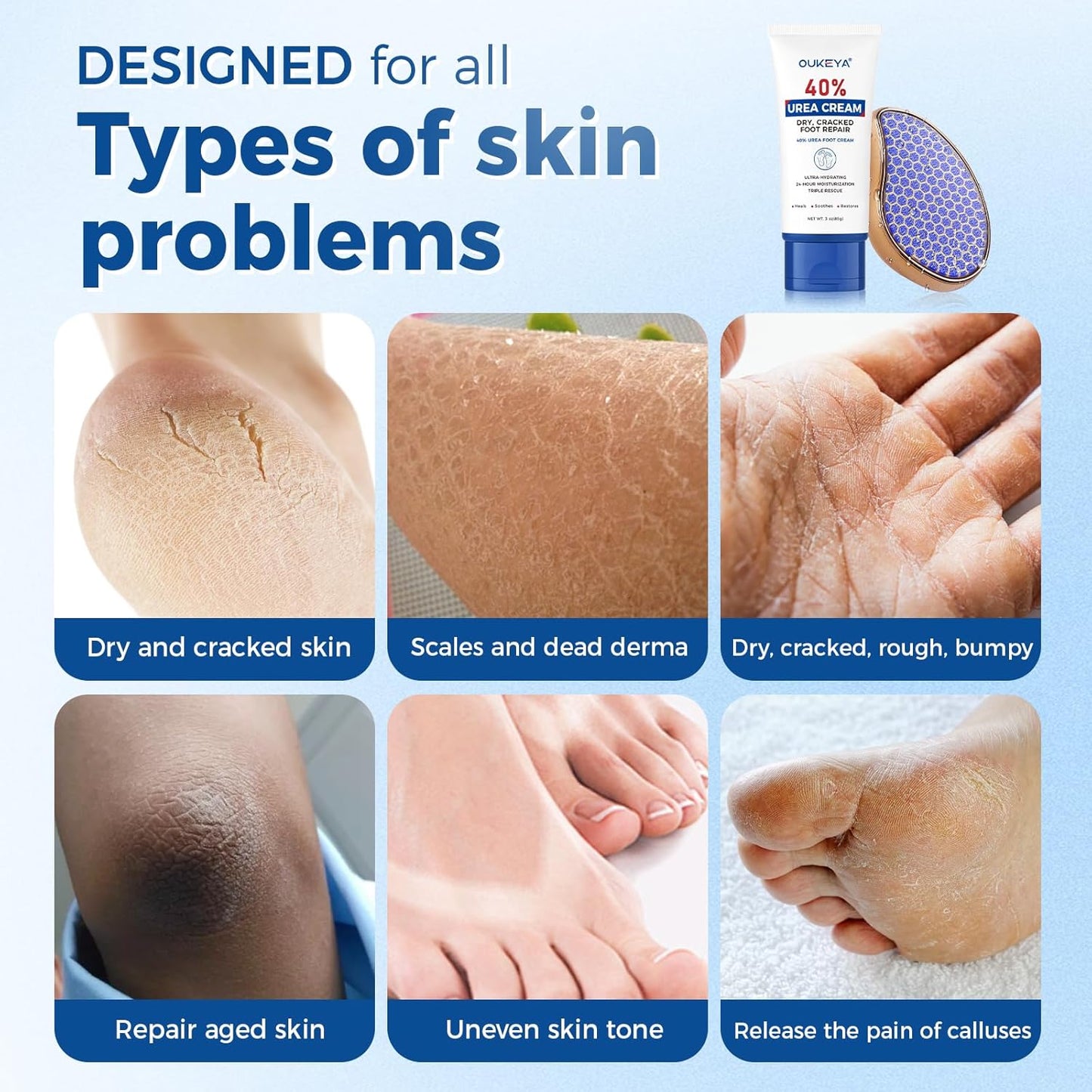 OUKEYA Urea Cream 40 Percent Tube, Urea Cream 40 Percent For Feet Maximum Strength, with Foot Callus Remover, Nano Glass Foot File