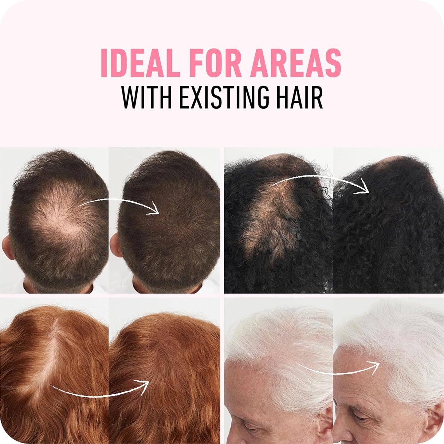 BOLDIFY Hair Fibers (56g) - Fill In Thinning and Fine Hair for an Instantly Fuller, Thicker Look - 14 Shades for Women & Men - Dark Gray