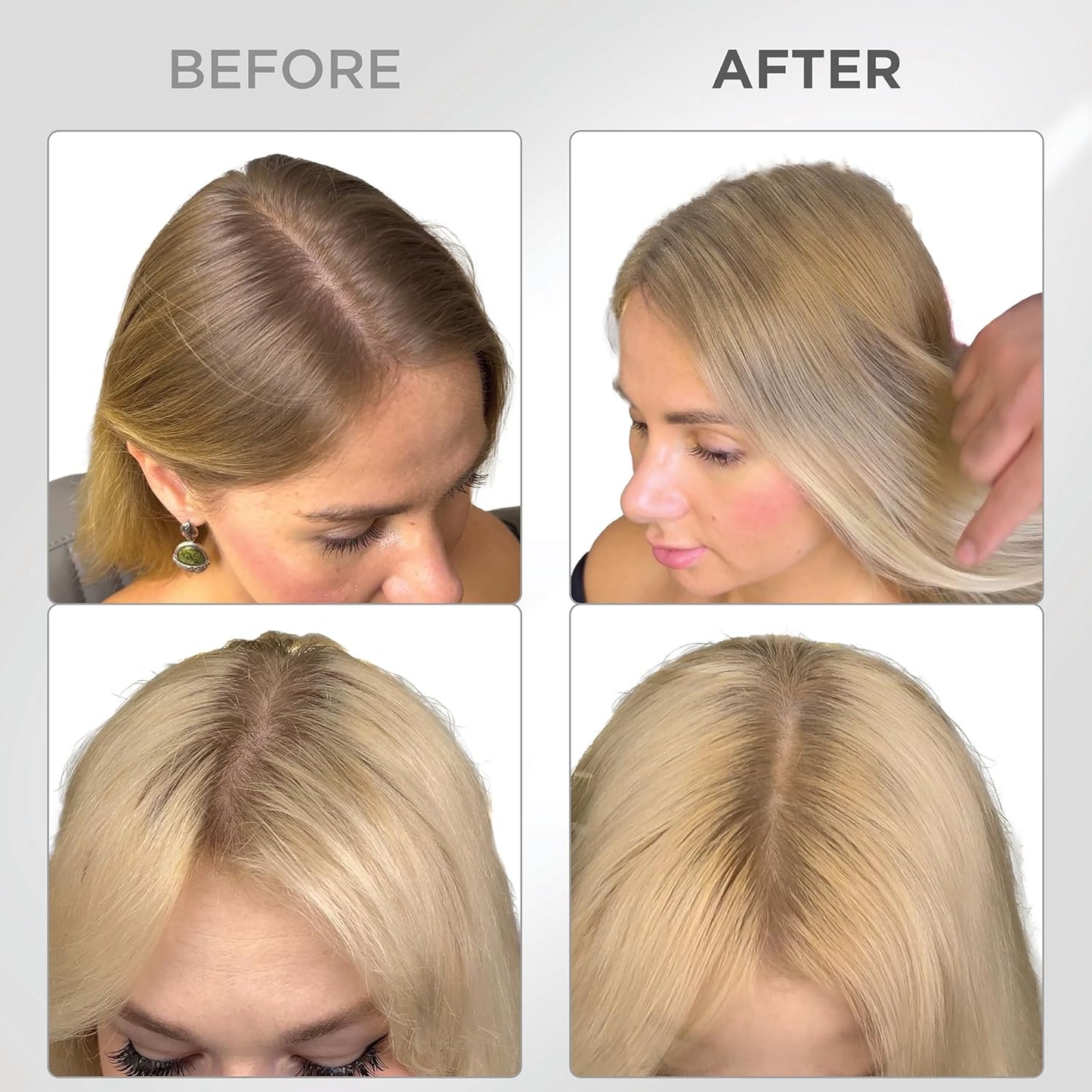 THICK FIBER Root Touch Up & Hairline Powder with Brush (LARGE 10g) – Covers Grey Roots, Thinning Hair & Bald Spots – Sweat & Water Resistant Hair Concealer for Women & Men (Medium Blonde)