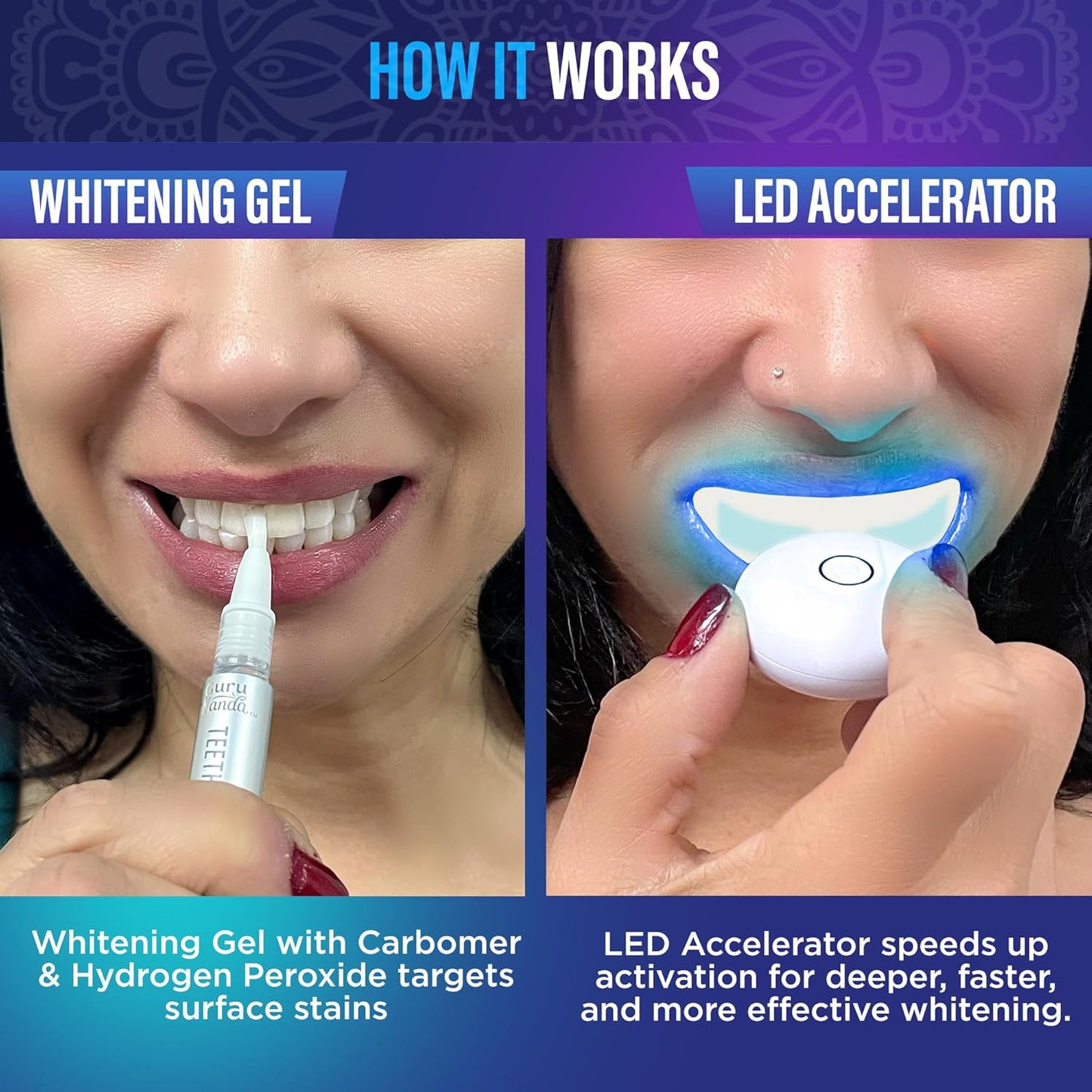 GuruNanda Professional Teeth Whitening Wireless Kit with LED Light & Whitening Pen, Helps Remove Surface Stains from Coffee, Food, Soda, 40 Treatments
