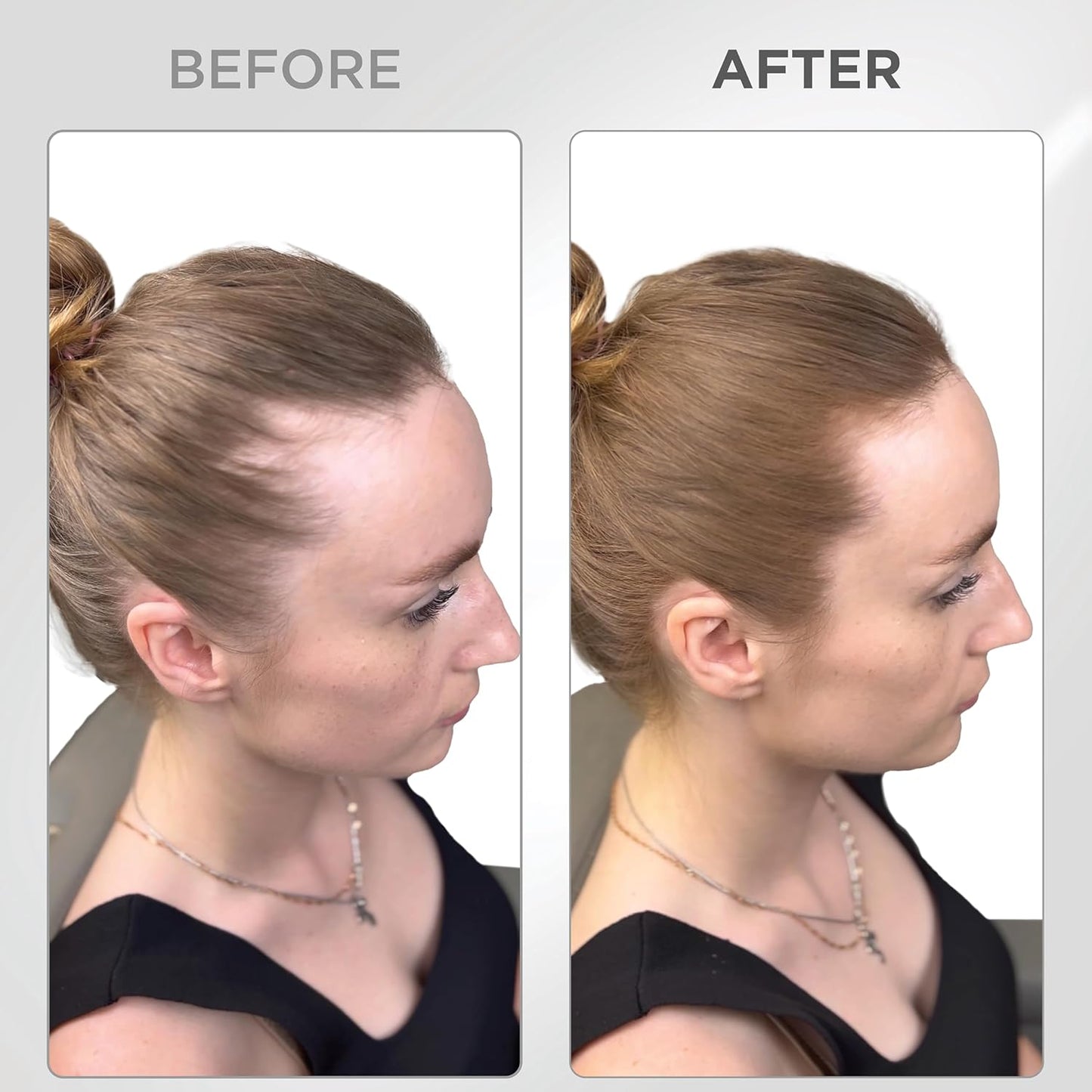 THICK FIBER Root Touch Up Set - Water & Sweat Resistant Hair Loss Concealer for Thinning Hair Women, Includes Hairline Powder and Brush (Auburn)