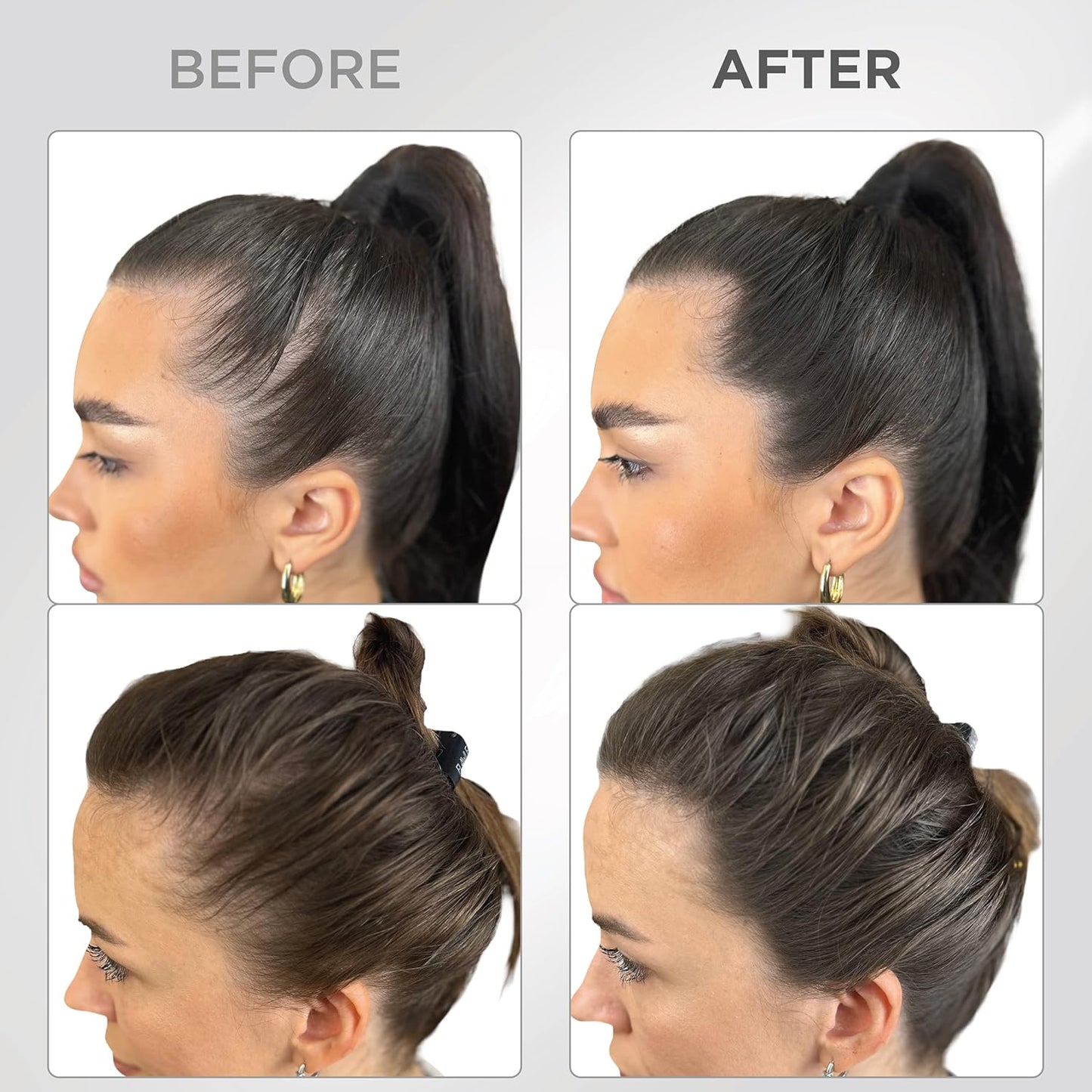 THICK FIBER Root Touch Up & Hairline Powder with Brush (LARGE 10g) – Covers Grey Roots, Thinning Hair & Bald Spots – Sweat & Water Resistant Hair Concealer for Women & Men (Dark Brown)