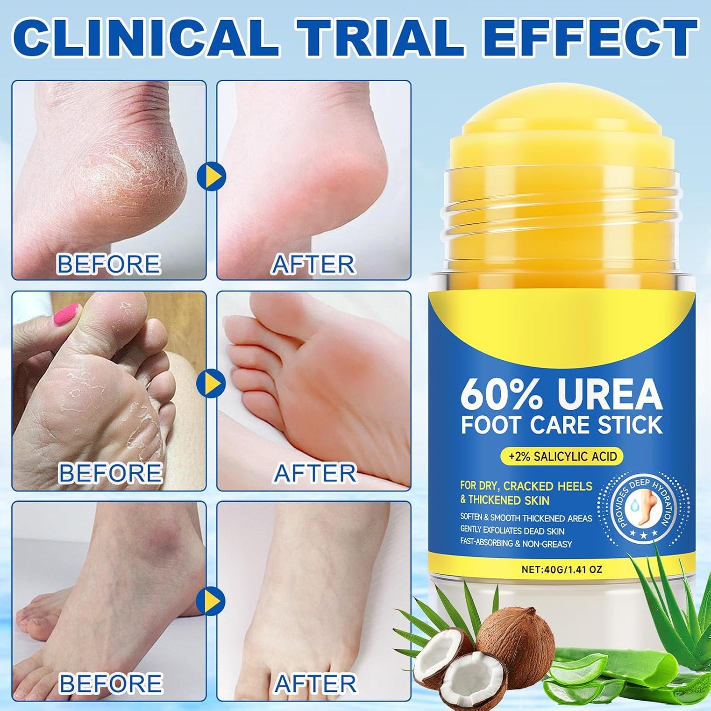 WHLH & WELL-BEING Urea Foot Care Stick & Cream - Moisturizer for Dry, Cracked Skin on Feet, Knees, Elbows & Hands - Hydrates & Repairs Rough Skin