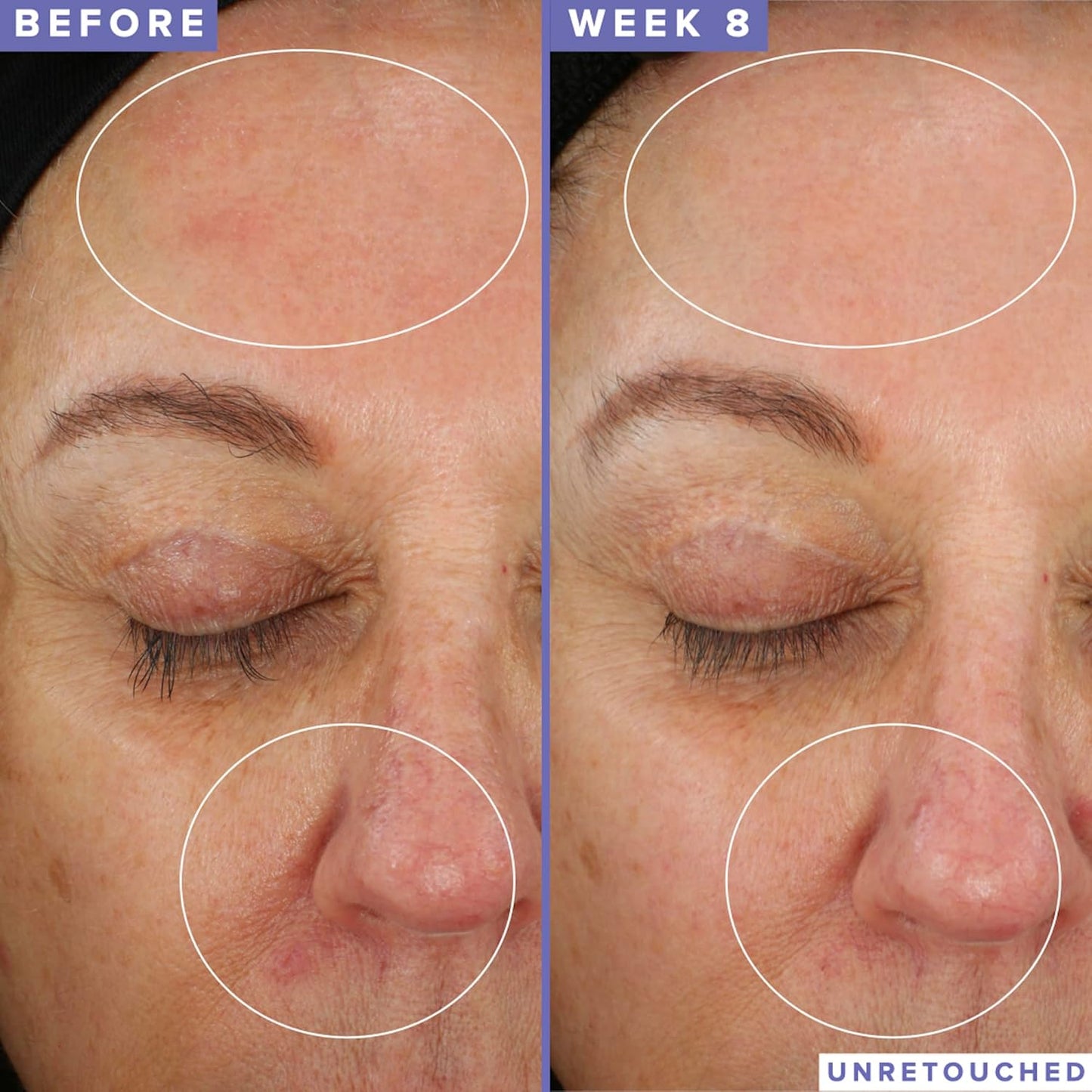 Farmacy Niacinamide Overnight Face Mask - Pore Refining Facial Mask with 10% Niacinamide - Replenishes Moisture Barrier with 3% Panthenol + Blueberry Seed Oil for Soft, Supple Skin (9ml)