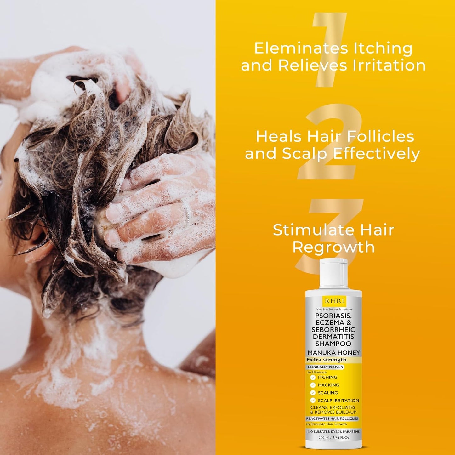 Antifungal Psoriasis Shampoo, Eczema, Seborrheic Dermatitis Shampoo | Soothes Itching, Flaking & Irritation | Repairs Scalp, Strengthens Hair, Stimulates Regrowth | Medicated Scalp Treatment