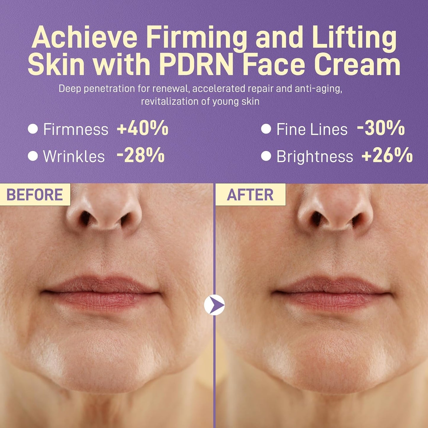 PDRN Anti-Aging Face Moisturizers Cream with 5% Squalane,100% Pure PDRN Salmon Sperm DNA,Hyaluronic Acid & B5, Firming, Hydrating, Moisturizing Repair Face & Neck Skinare Cream for All Skin,1.85 Fl Oz