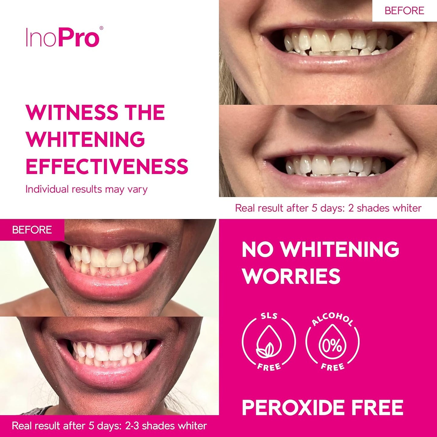 Teeth Whitening Strips 21 Treatments Kit - Teeth Whitener, Peroxide Free, Green White Strips for Teeth Whitening with Arbutin, Coconut Oil, Deep Stains Removal (42 Strips)