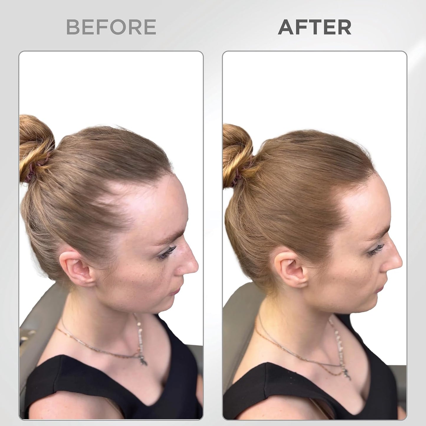 THICK FIBER Root Touch Up & Hairline Powder with Brush (LARGE 10g) – Covers Grey Roots, Thinning Hair & Bald Spots – Sweat & Water Resistant Hair Concealer for Women & Men (Auburn)