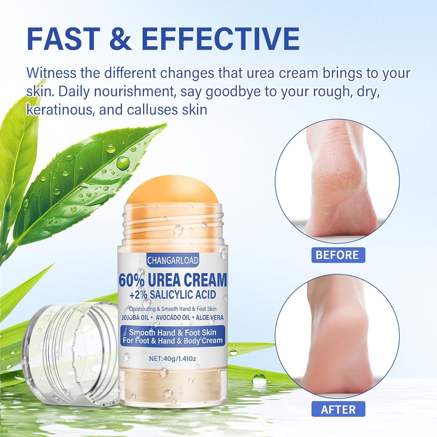Urea Cream 60 Percent For Feet Maximum Strength - Intensive Repair Dry Cracked Skin, Urea Cream For Foot, Foot Cream For Dry Cracked Heels and Feet, 2 Pcs - 1.41 Oz