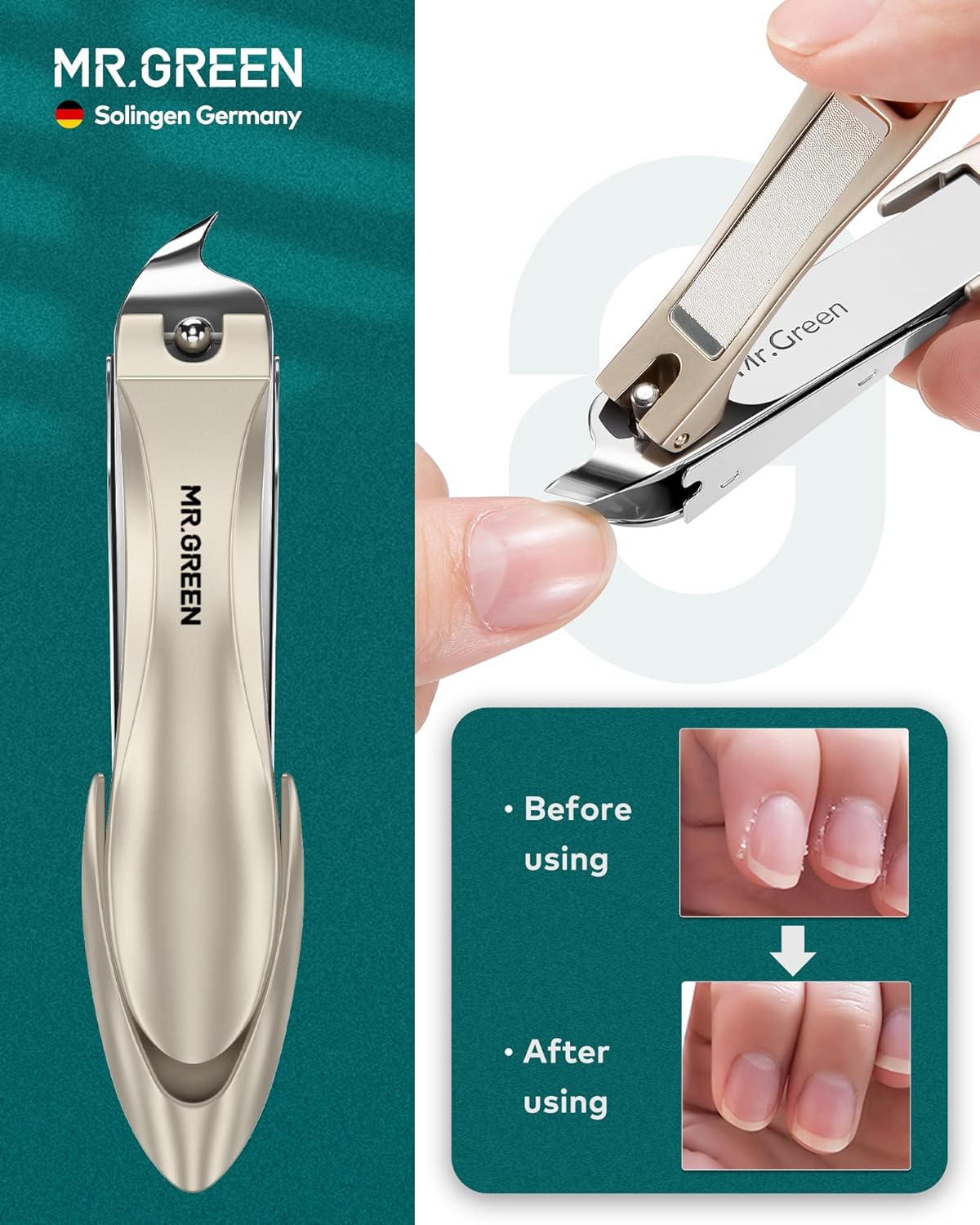 MR.GREEN Manicure Set, German Stainless Nail Clippers Set Anti Splash, Heavy Duty Fingernail& Toenail Clipper for Men& Women, Professional Personal Care Tools with Exquisite Travel Case