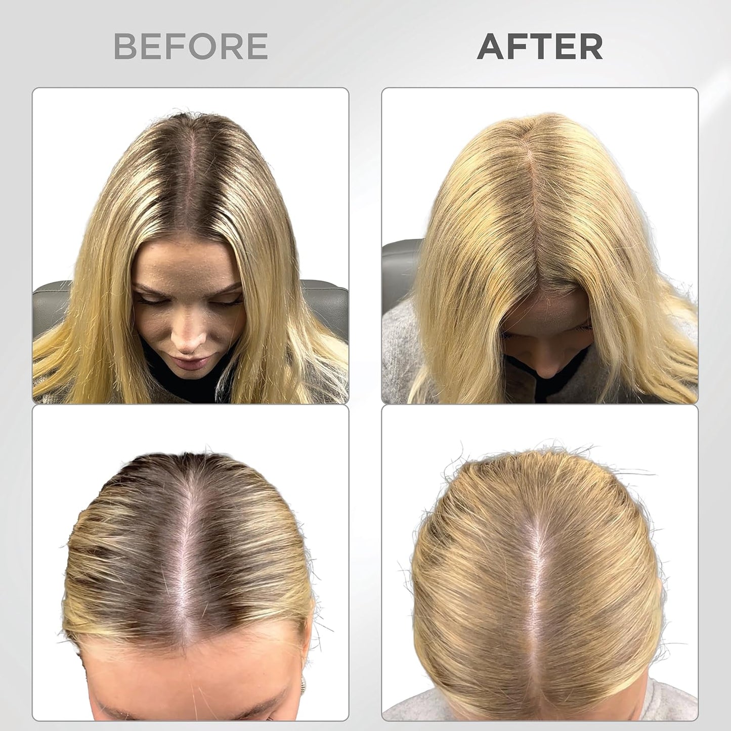 THICK FIBER Root Touch Up & Hairline Powder with Brush (LARGE 10g) – Covers Grey Roots, Thinning Hair & Bald Spots – Sweat & Water Resistant Hair Concealer for Women & Men (Blonde)