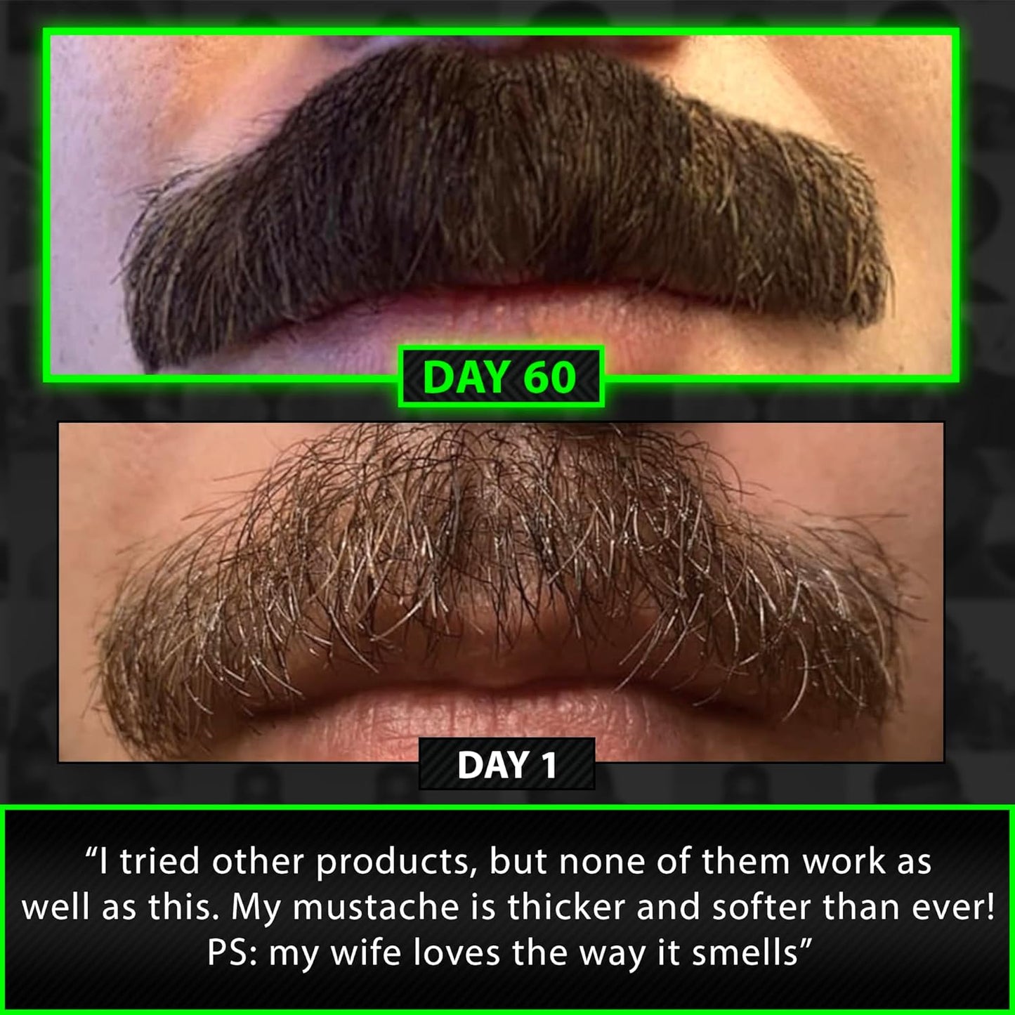 GROW Beard Growth Serum + 2X Biotin Beard Balm – Thickening Conditioner with Castor Oil & Meadowfoam – Fills Patches, Boosts Growth, Softens & Styles – For Thicker, Fuller Men's Facial Hair