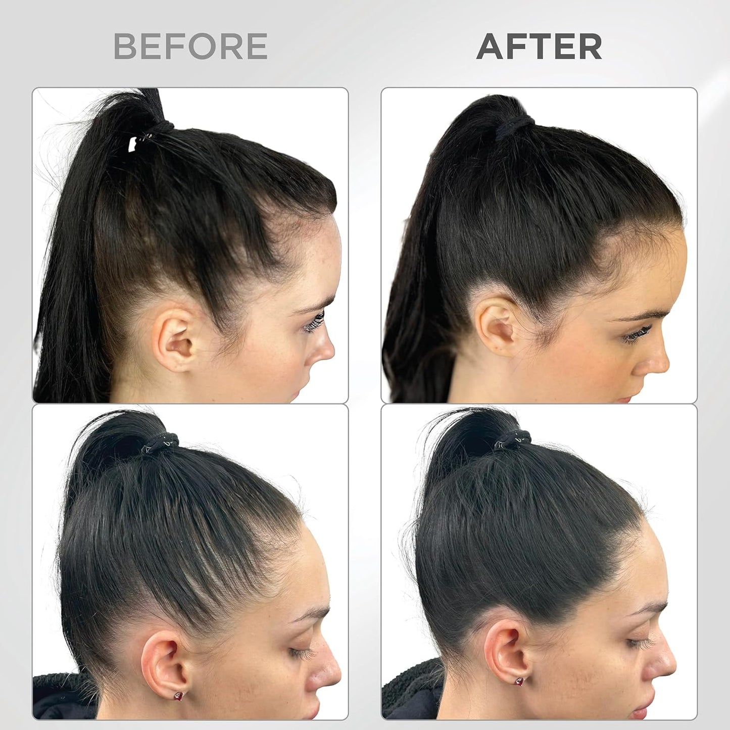 THICK FIBER Root Touch Up & Hairline Powder with Brush (LARGE 10g) – Covers Grey Roots, Thinning Hair & Bald Spots – Sweat & Water Resistant Hair Concealer for Women & Men (Black)