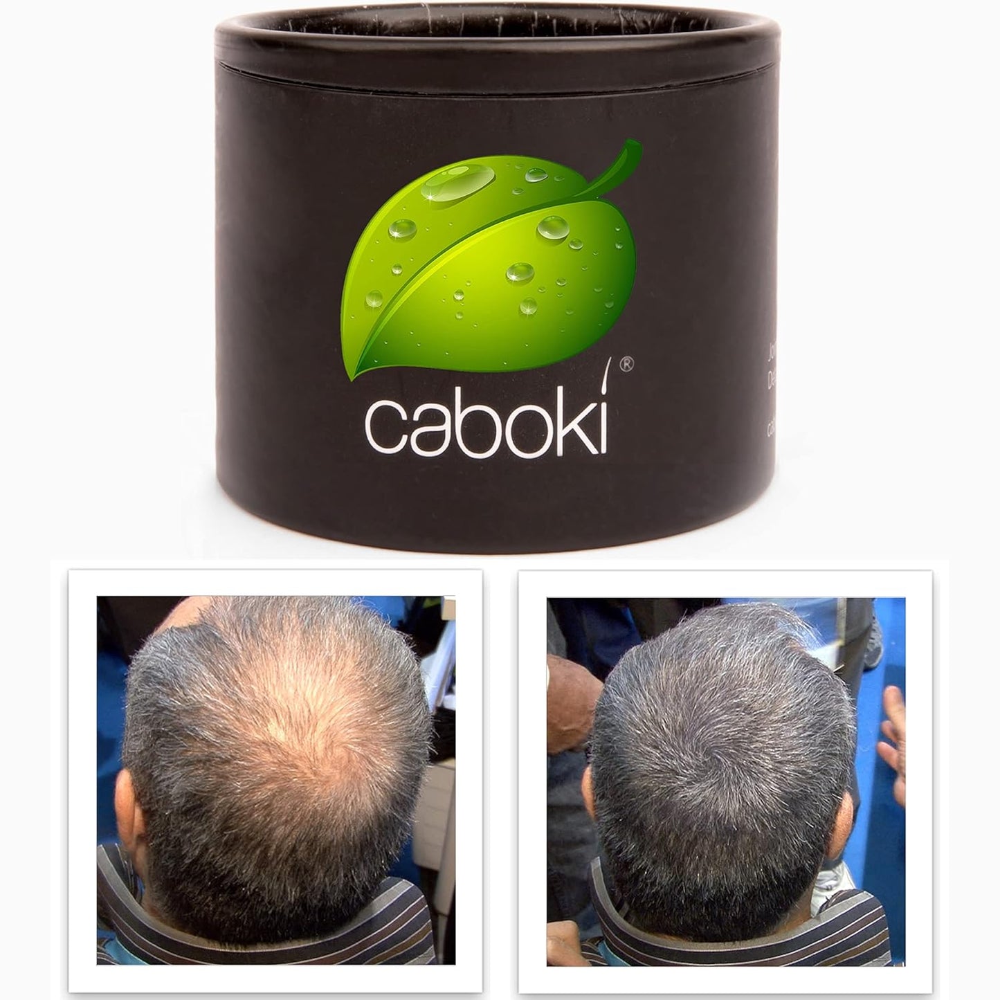 Hair Fibers For Hair Loss. Cover Bald Spot and Thinning Hair Instantly. Make Thin Hair Look 10X Fuller. All-Natural Hair Building Fiber. Trial Size (10-Day Supply). Dark Gray