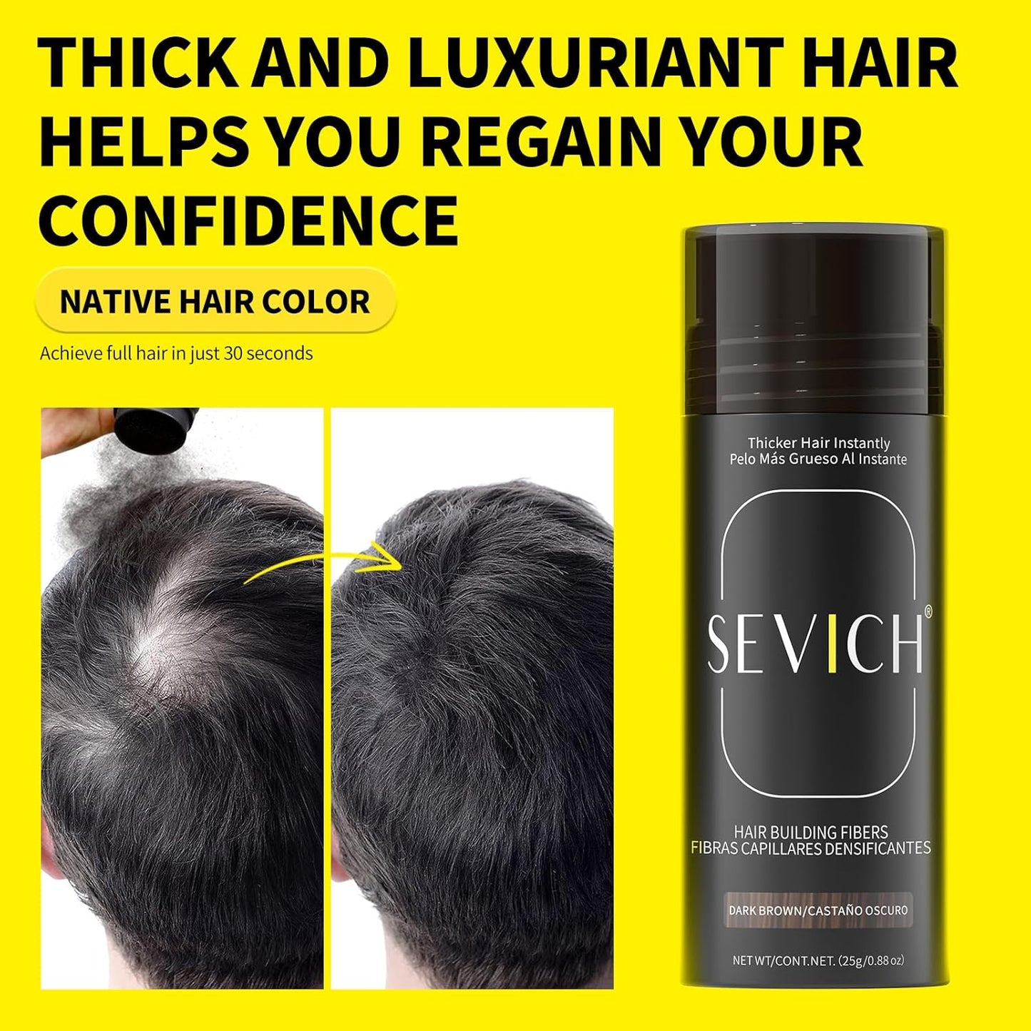SEVICH Hair Fibers with Spray Applicator - Natural-Looking Hair Thickening Fibers for Men & Women, Instant Fullness, Wind & Water Resistant, Easy Wash Out, 25g (Black)