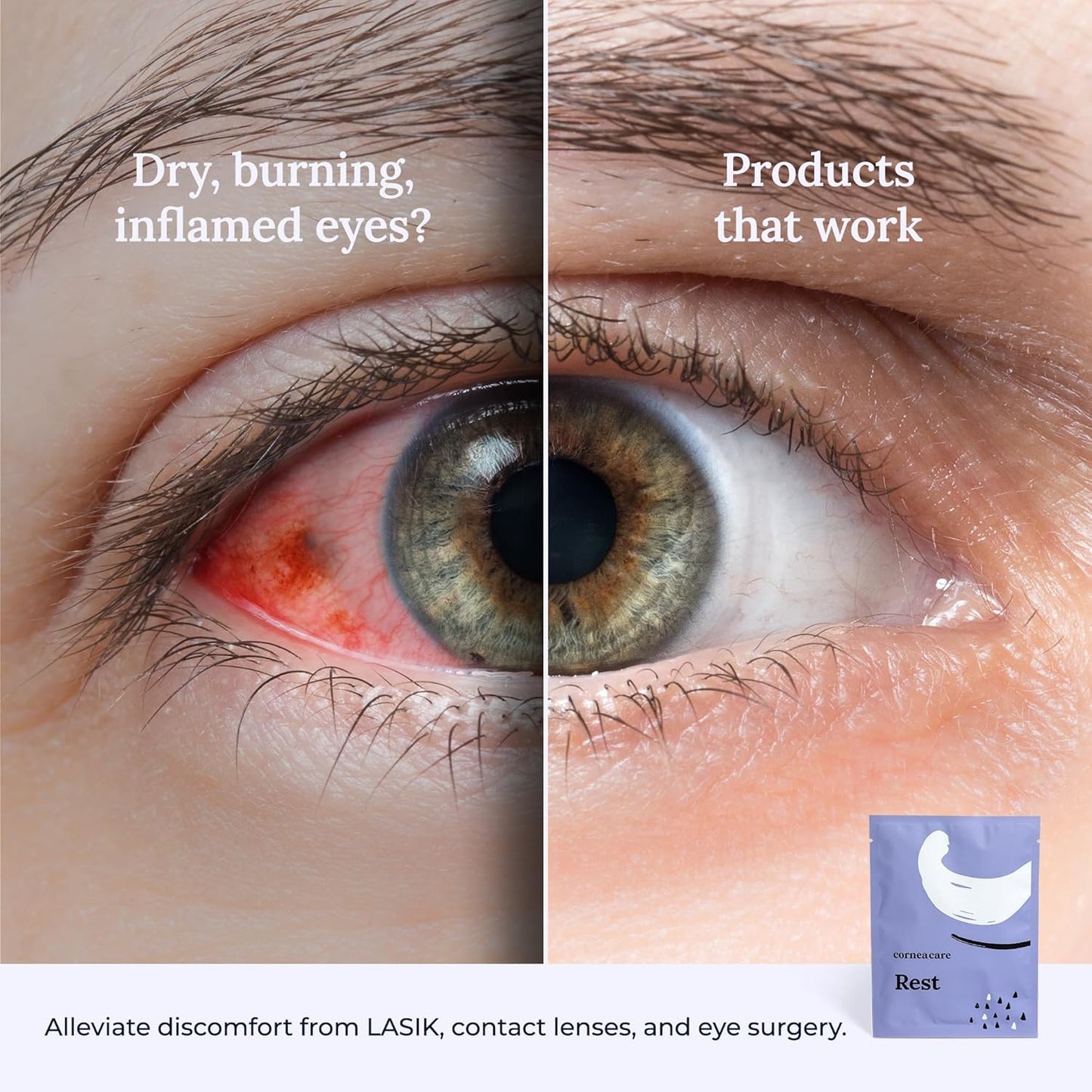 CorneaCare Rest: Self Heating Warm Compress for Dry Eyes | Heated Eye Mask for Fast Relief | No Microwave or Washcloth Needed | Travel Ready | 30 Count