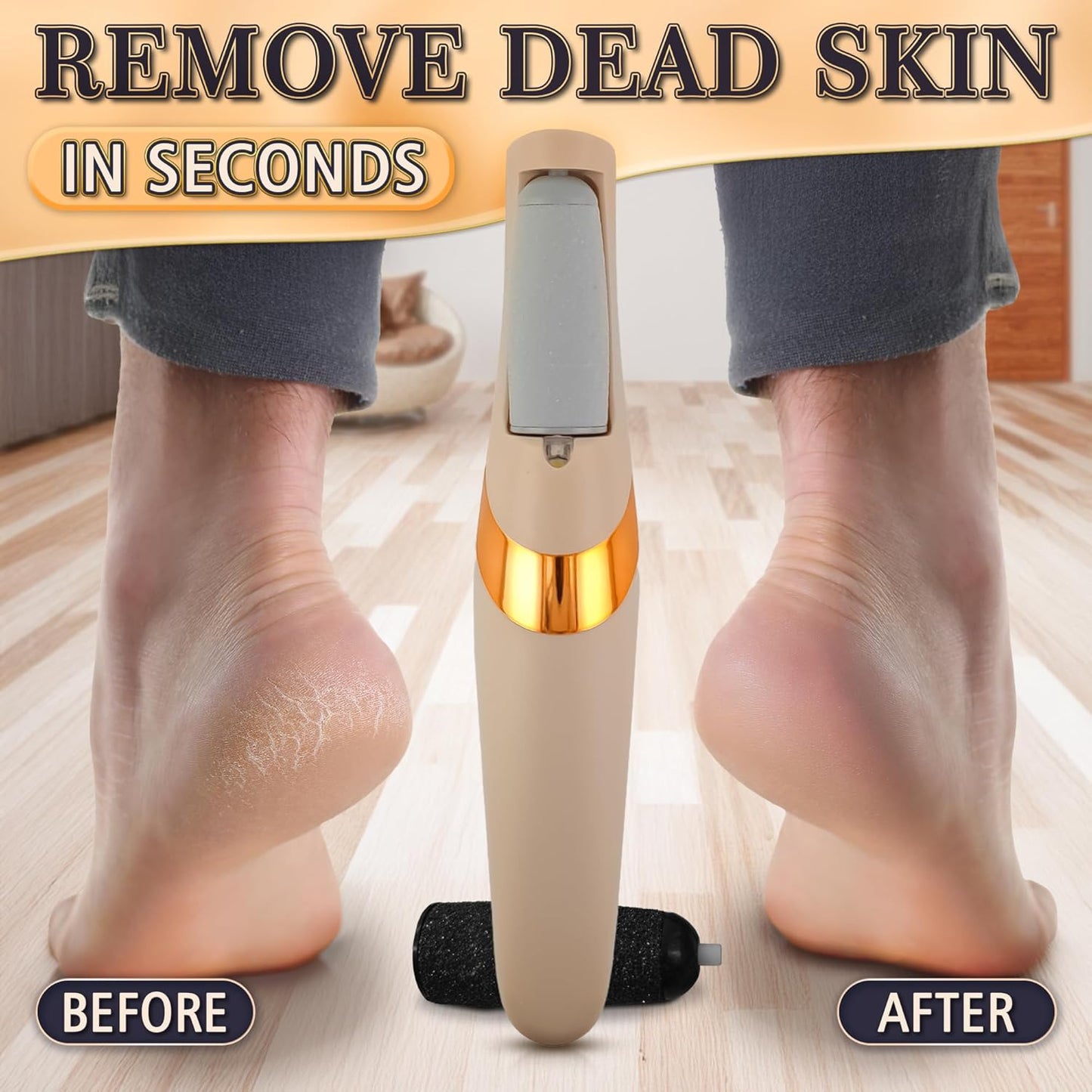 Electric Callus Remover for Feet – Rechargeable Electric Foot Callus Remover Tool with 2-Speed Foot Sander with 2 Rollers (Coarse & Fine) for Smooth & Soft Feet – Compact for Daily & Travel Use