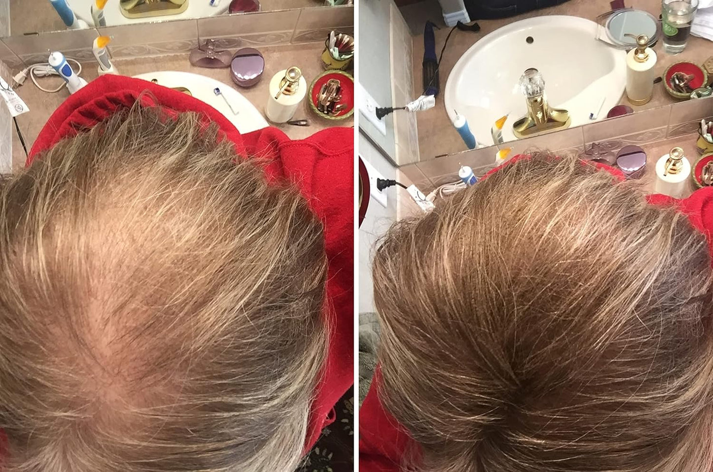 Quick Fix For Thinning Hair and Bald Spot. Get 10X Fuller Hair Instantly. All-Natural Hair Building Fiber For Hair. Trial Size (10-Day Supply). Light Brown