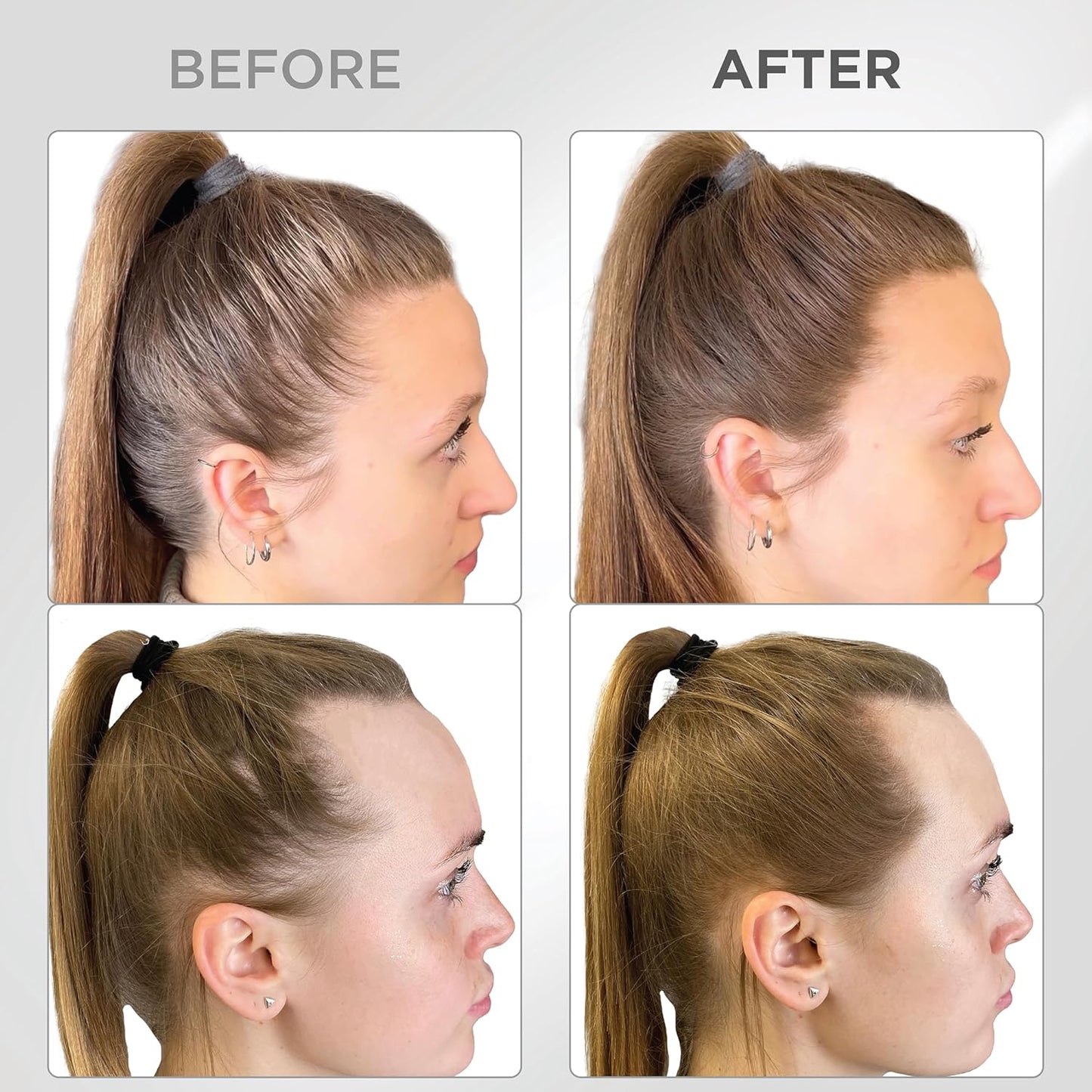 THICK FIBER Root Touch Up & Hairline Powder with Brush (LARGE 10g) – Covers Grey Roots, Thinning Hair & Bald Spots – Sweat & Water Resistant Hair Concealer for Women & Men (Light Brown)