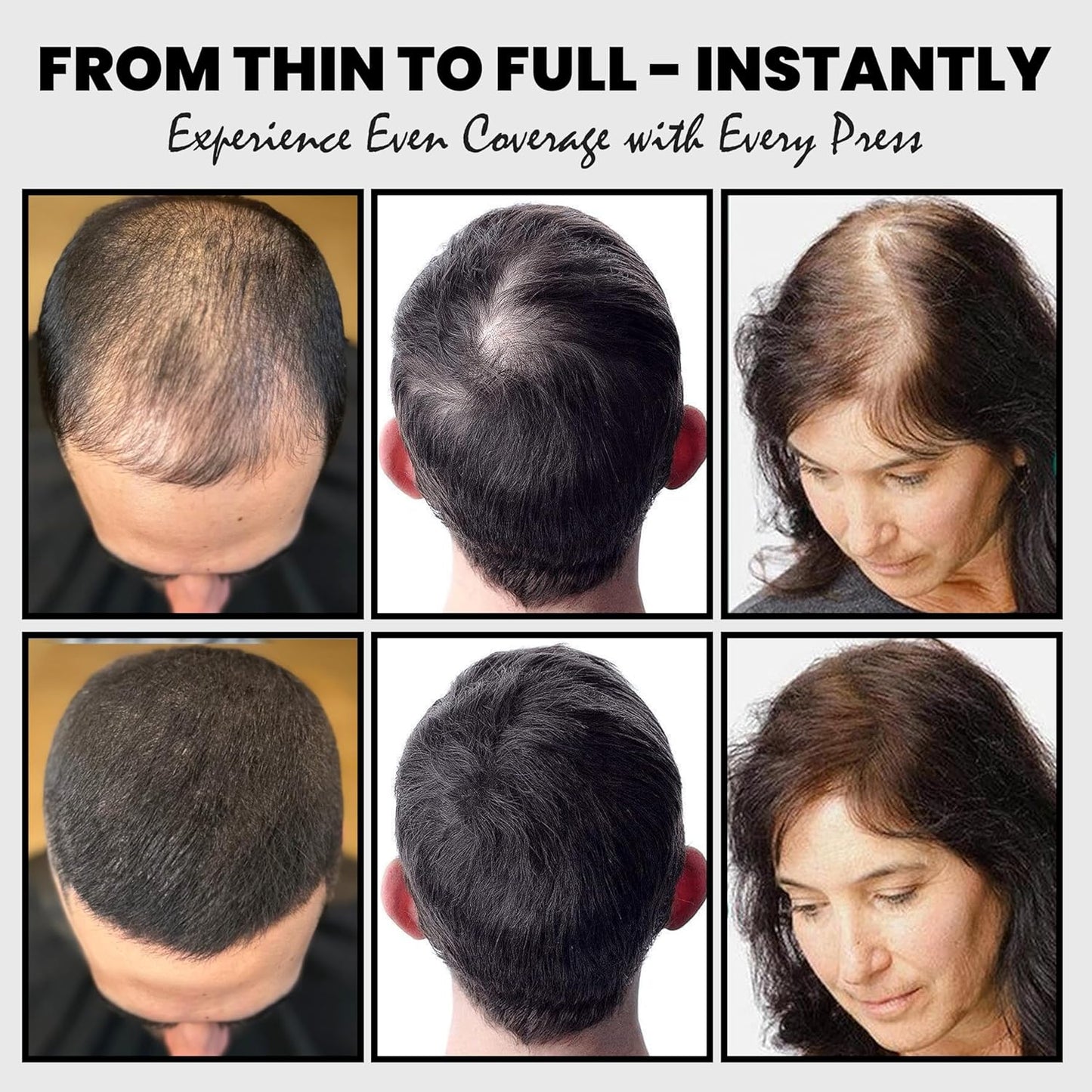 2PCS Hair Fibers for Thinning Hair, Hair Building Fibers Powder Set, Instant Coverage Bald Spots Hair Loss for Men & Women with Spray Applicator (Dark Brown, 15g*2)